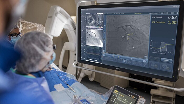 Two doctors looking at a screen showing a scan