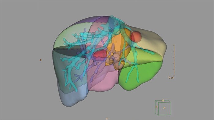 Prostatitis számítógépes tomográfia. Mit vizsgál a CT és a vesék és a mellékvesék?