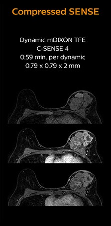 clinical image breast compressed sense 1