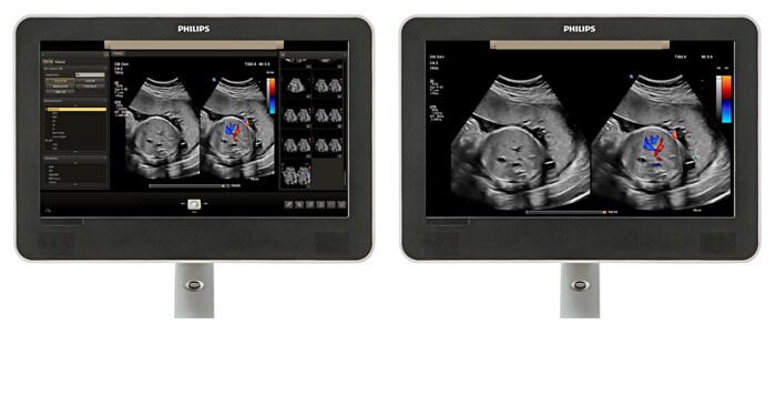 Viewing area comparison with an obstetrics image on screen.