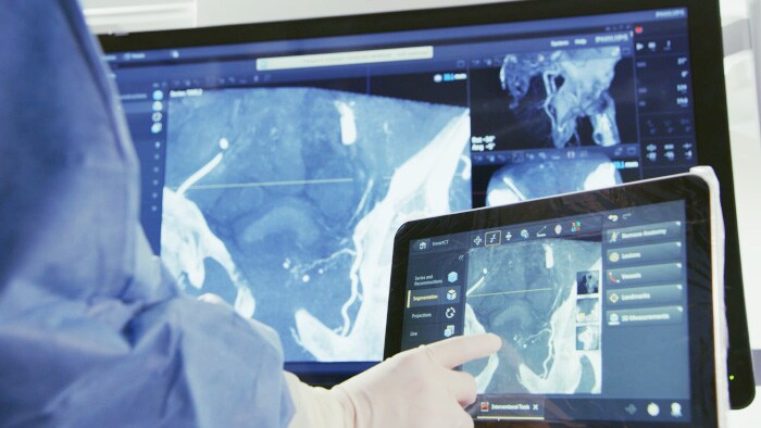 Azurion SmartCT Soft Tissue