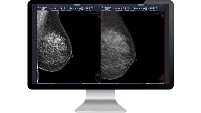 mammography no icon