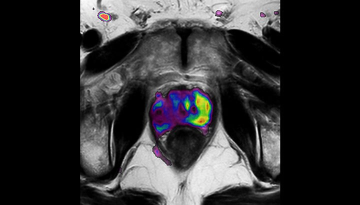 Functional imaging