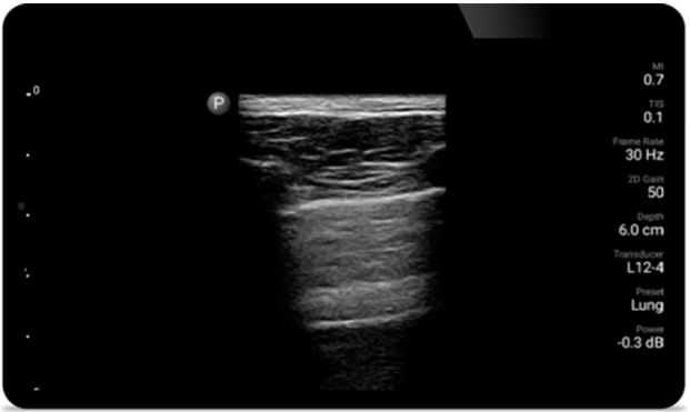 Second case image