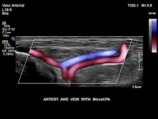 VASC ART_VEINS MCPA